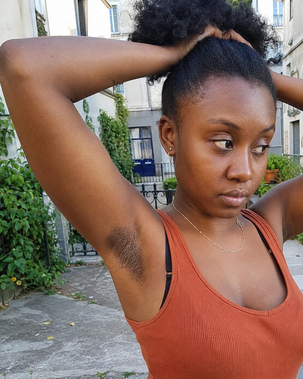 Pourquoi des taches foncées apparaissent-elles sur les aisselles, le maillot et les cuisses ?